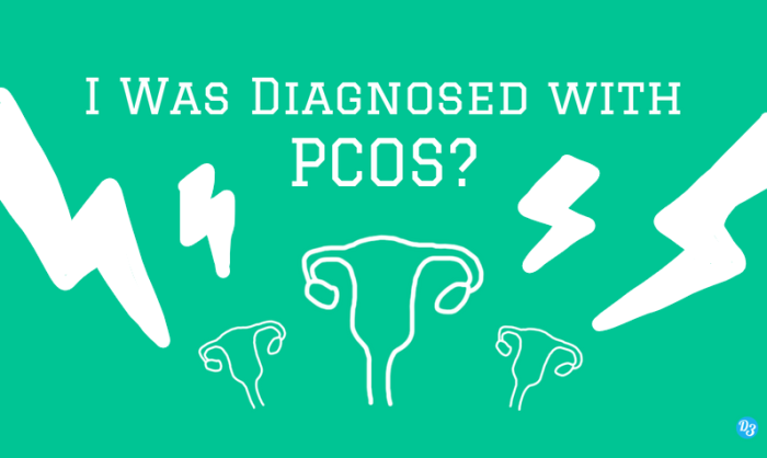 I was Diagnosed with PCOS_